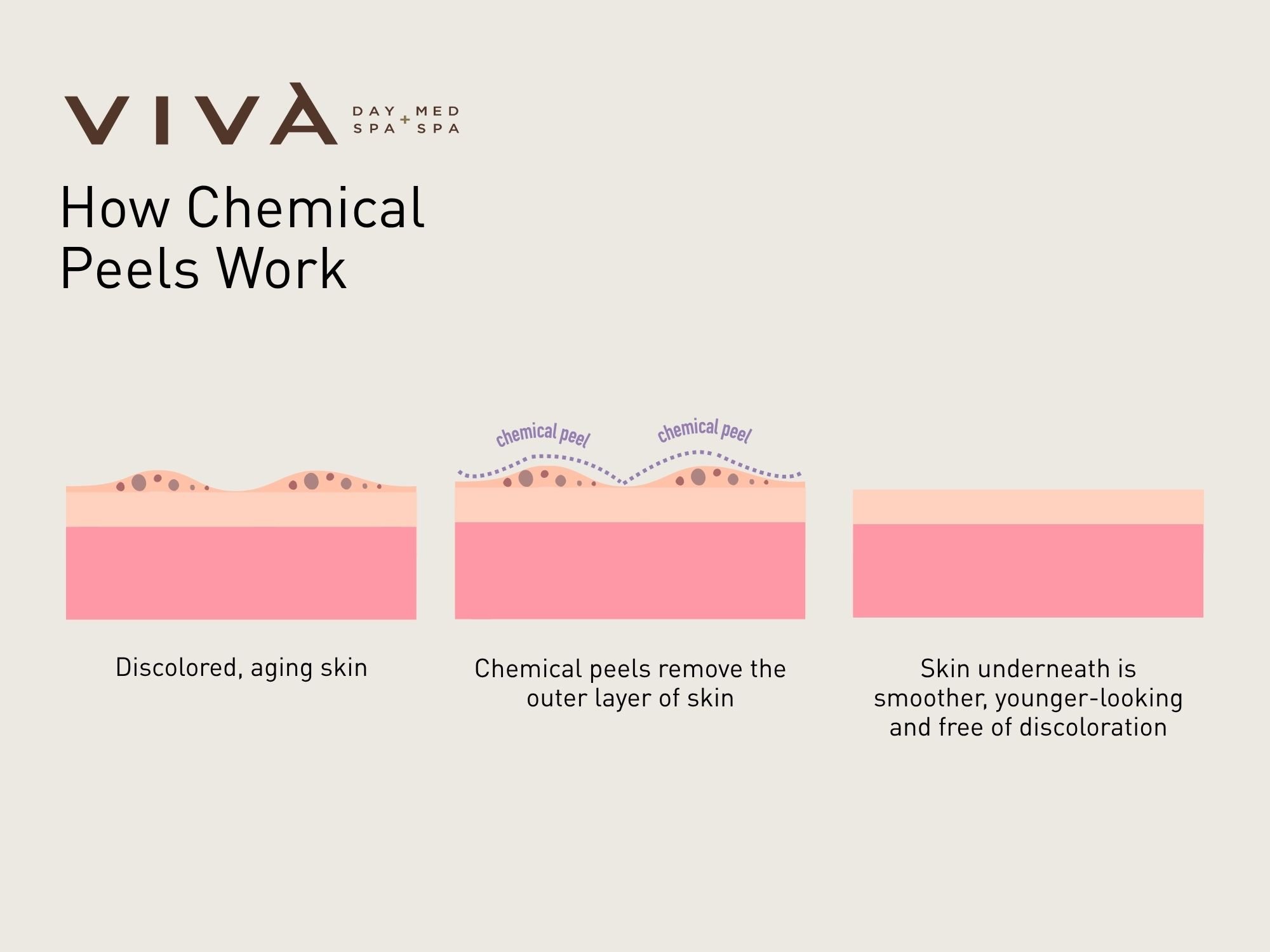 How Chemical Peels Work - Diagram
